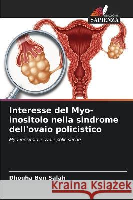 Interesse del Myo-inositolo nella sindrome dell'ovaio policistico Dhouha Ben Salah   9786205300978 Edizioni Sapienza