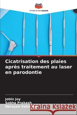 Cicatrisation des plaies après traitement au laser en parodontie Joy, Jobin 9786205311882