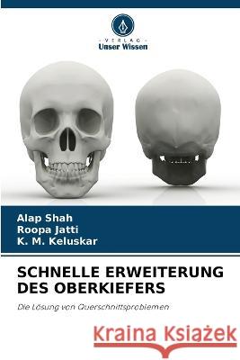 Schnelle Erweiterung Des Oberkiefers Alap Shah Roopa Jatti K M Keluskar 9786205315361