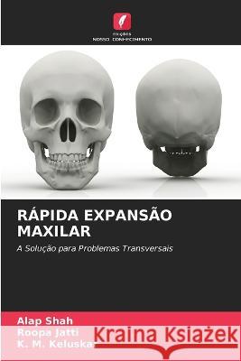 Rápida Expansão Maxilar Shah, Alap 9786205315408 Edicoes Nosso Conhecimento