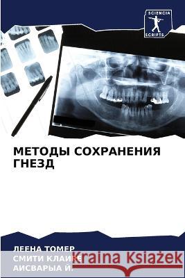 МЕТОДЫ СОХРАНЕНИЯ ГНЕЗД Томер, 9786205316962 Sciencia Scripts