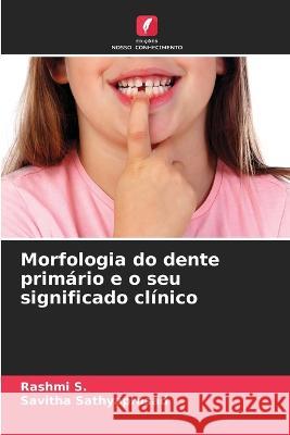 Morfologia do dente primário e o seu significado clínico S, Rashmi 9786205320822 Edicoes Nosso Conhecimento
