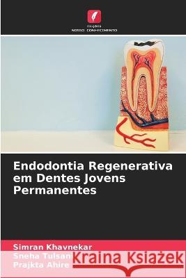 Endodontia Regenerativa em Dentes Jovens Permanentes Simran Khavnekar Sneha Tulsani Prajkta Ahire 9786205326138