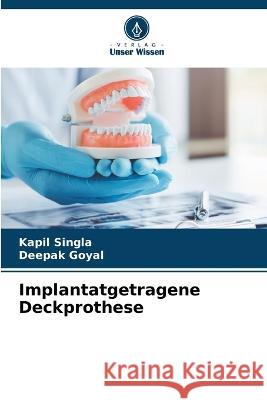 Implantatgetragene Deckprothese Kapil Singla Deepak Goyal  9786205330647 Verlag Unser Wissen