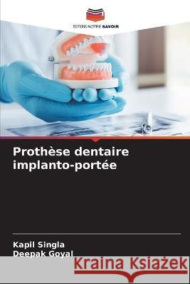 Prothèse dentaire implanto-portée Singla, Kapil 9786205330661 Editions Notre Savoir