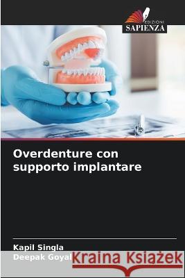 Overdenture con supporto implantare Kapil Singla Deepak Goyal  9786205330678 Edizioni Sapienza