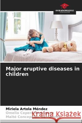 Major eruptive diseases in children Miriela Artola Mendez Omelio Cepero Rodriguez Maite Concepcion Hernandez 9786205331743