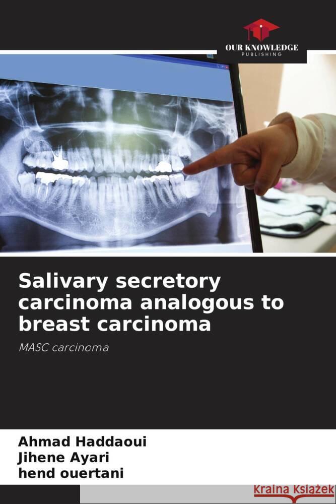 Salivary secretory carcinoma analogous to breast carcinoma Haddaoui, Ahmad, Ayari, Jihene, Ouertani, Hend 9786205340677