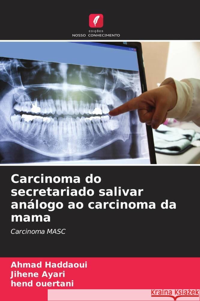 Carcinoma do secretariado salivar análogo ao carcinoma da mama Haddaoui, Ahmad, Ayari, Jihene, Ouertani, Hend 9786205340707