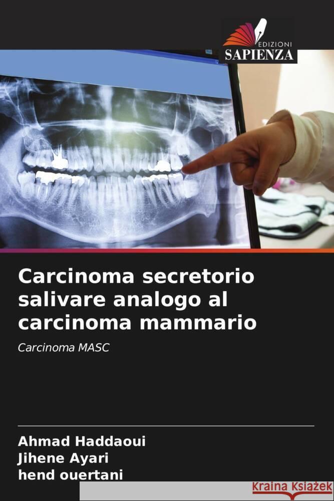 Carcinoma secretorio salivare analogo al carcinoma mammario Haddaoui, Ahmad, Ayari, Jihene, Ouertani, Hend 9786205340721