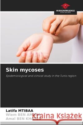 Skin mycoses Latifa Mtibaa, Wiem Ben Amara, Amal Ben Khater 9786205353585 Our Knowledge Publishing