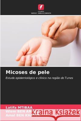 Micoses de pele Latifa Mtibaa, Wiem Ben Amara, Amal Ben Khater 9786205353615 Edicoes Nosso Conhecimento