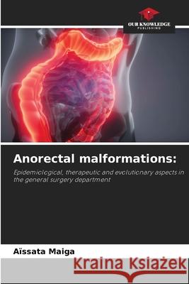 Anorectal malformations Aïssata Maiga 9786205354513