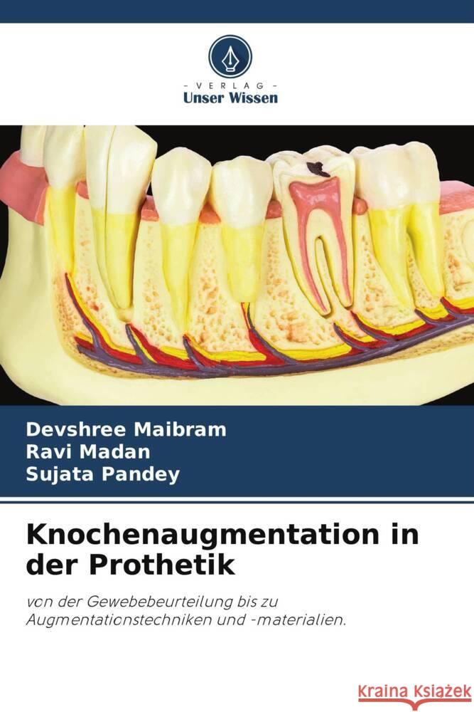 Knochenaugmentation in der Prothetik Maibram, Devshree, Madan, Ravi, Pandey, Sujata 9786205362884 Verlag Unser Wissen