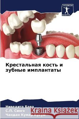 Крестальная кость и зубные импла Ниведита Бава, С.П. Си
 9786205368909 Sciencia Scripts