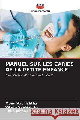 Manuel Sur Les Caries de la Petite Enfance Monu Vashishtha, Vikalp Vashishtha, Bibin Jacob Emmanuel 9786205369401 Editions Notre Savoir