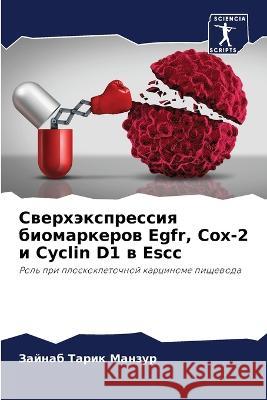 Сверхэкспрессия биомаркеров Egfr, Cox-2 
 Зайнаб Тарик Манзур 9786205370049 Sciencia Scripts