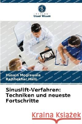 Sinuslift-Verfahren: Techniken und neueste Fortschritte Husain Mograwala, Rajshekhar Halli 9786205371213