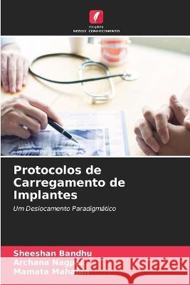 Protocolos de Carregamento de Implantes Sheeshan Bandhu, Archana Nagpal, Mamata Mahajan 9786205371466 Edicoes Nosso Conhecimento