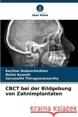 CBCT bei der Bildgebung von Zahnimplantaten Kavitaa Nedunchezhian, Nalini Aswath, Sarumathi Thirugnanamurthy 9786205379387