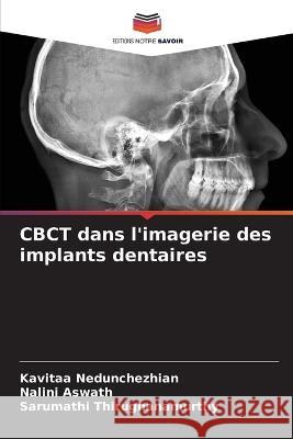 CBCT dans l\'imagerie des implants dentaires Kavitaa Nedunchezhian Nalini Aswath Sarumathi Thirugnanamurthy 9786205379417 Editions Notre Savoir