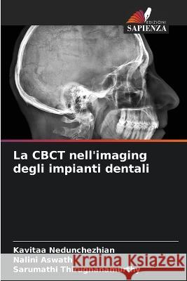 La CBCT nell\'imaging degli impianti dentali Kavitaa Nedunchezhian Nalini Aswath Sarumathi Thirugnanamurthy 9786205379448 Edizioni Sapienza