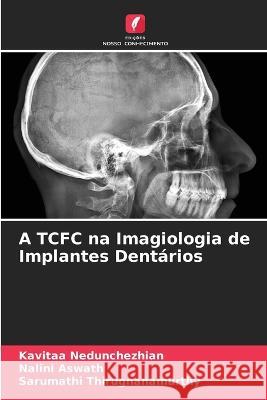 A TCFC na Imagiologia de Implantes Dentários Kavitaa Nedunchezhian, Nalini Aswath, Sarumathi Thirugnanamurthy 9786205379455