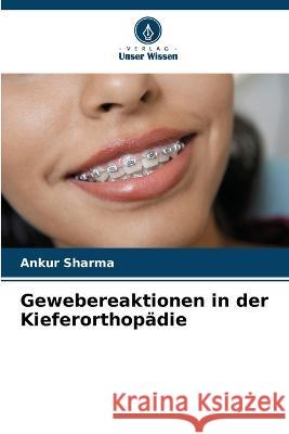 Gewebereaktionen in der Kieferorthopädie Ankur Sharma 9786205381885 Verlag Unser Wissen