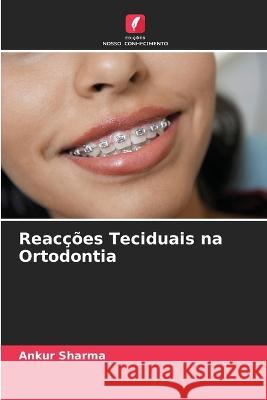 Reacções Teciduais na Ortodontia Ankur Sharma 9786205381922 Edicoes Nosso Conhecimento