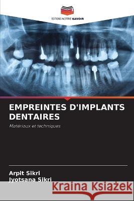 Empreintes d'Implants Dentaires Arpit Sikri, Jyotsana Sikri 9786205386996
