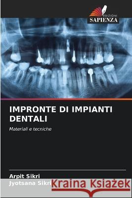 Impronte Di Impianti Dentali Arpit Sikri Jyotsana Sikri 9786205387009 Edizioni Sapienza