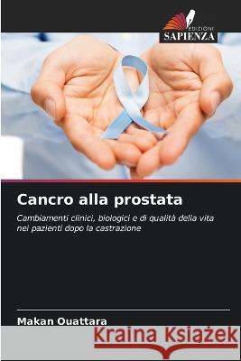 Cancro alla prostata Makan Ouattara   9786205390856 Edizioni Sapienza