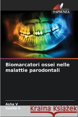 Biomarcatori ossei nelle malattie parodontali Asha V, Savita S 9786205394915 Edizioni Sapienza