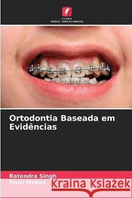 Ortodontia Baseada em Evidências Ratendra Singh, Stuti Mohan 9786205396506 Edicoes Nosso Conhecimento