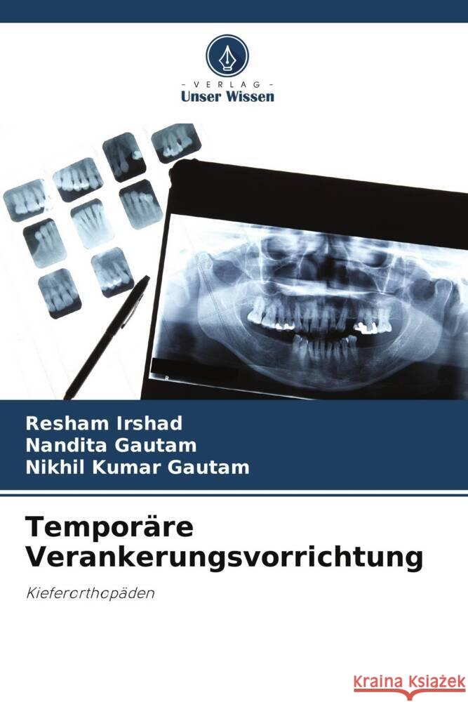 Temporäre Verankerungsvorrichtung Irshad, Resham, Gautam, Nandita, Gautam, Nikhil Kumar 9786205415986