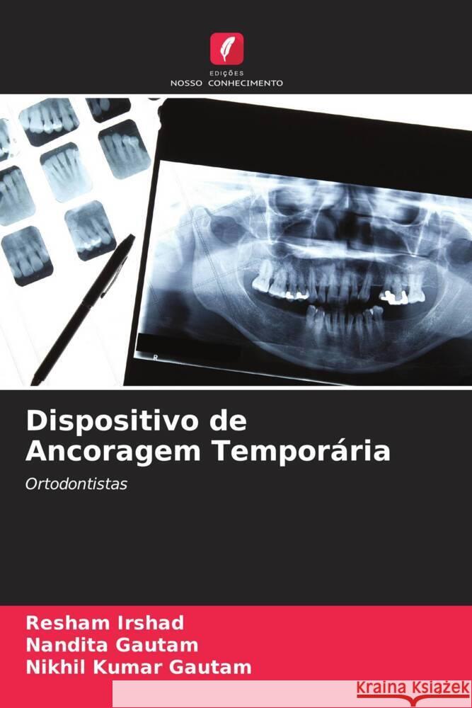 Dispositivo de Ancoragem Temporária Irshad, Resham, Gautam, Nandita, Gautam, Nikhil Kumar 9786205416020