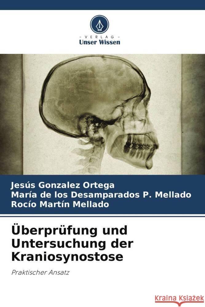 Überprüfung und Untersuchung der Kraniosynostose Ortega, Jesús Gonzalez, Mellado, María de los Desamparados P., Mellado, Rocío Martín 9786205421512