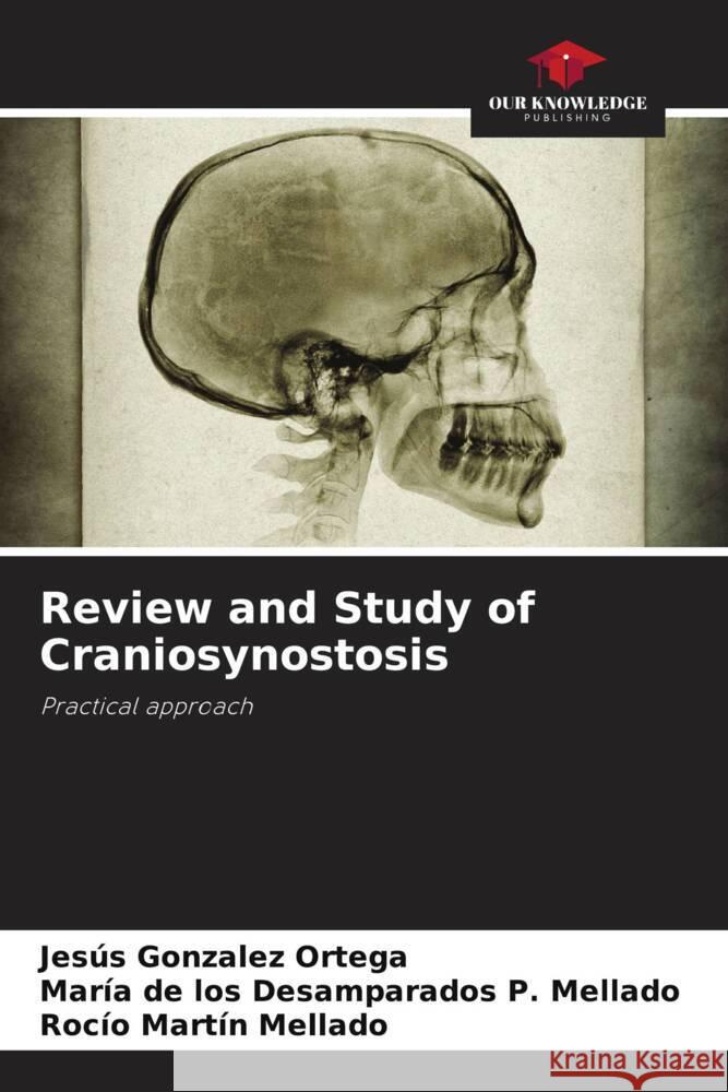 Review and Study of Craniosynostosis Ortega, Jesús Gonzalez, Mellado, María de los Desamparados P., Mellado, Rocío Martín 9786205421529