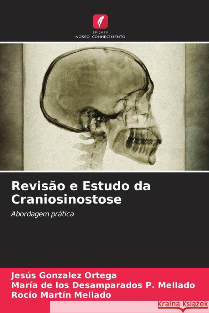 Revisão e Estudo da Craniosinostose Ortega, Jesús Gonzalez, Mellado, María de los Desamparados P., Mellado, Rocío Martín 9786205421567