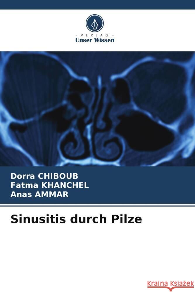 Sinusitis durch Pilze CHIBOUB, Dorra, khanchel, Fatma, AMMAR, Anas 9786205421932