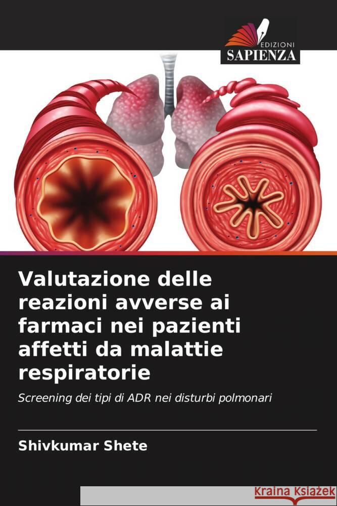 Valutazione delle reazioni avverse ai farmaci nei pazienti affetti da malattie respiratorie Shete, Shivkumar 9786205428528