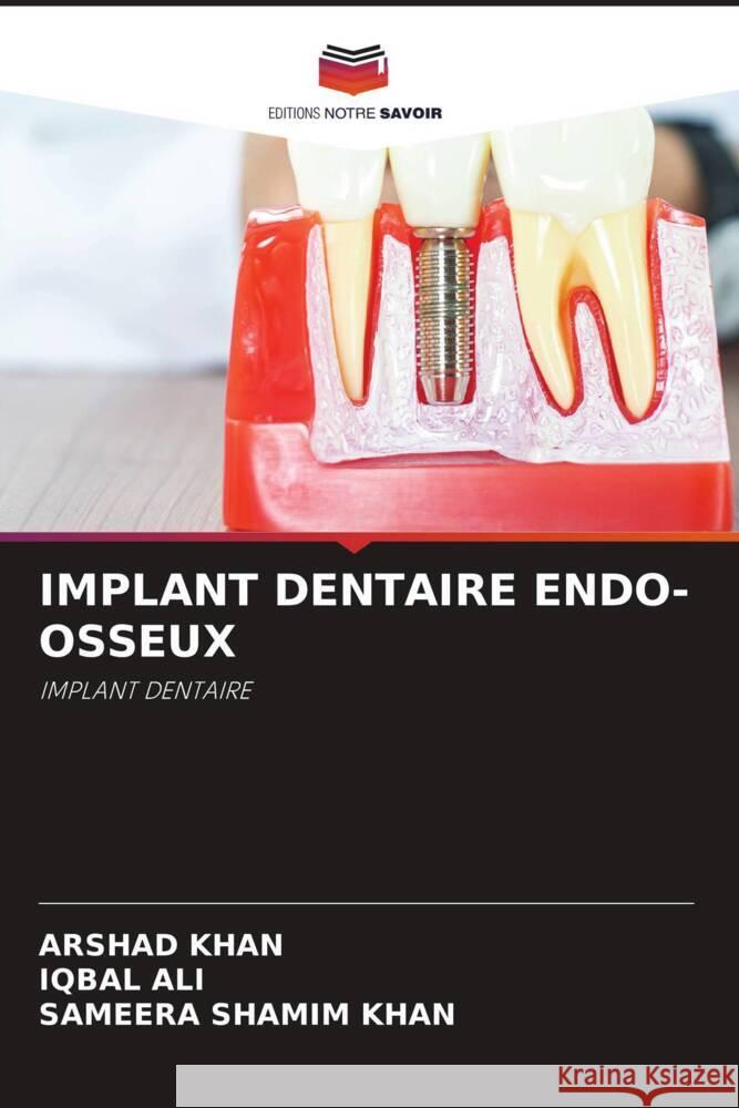 IMPLANT DENTAIRE ENDO-OSSEUX Khan, Arshad, Ali, Iqbal, Khan, Sameera Shamim 9786205435502