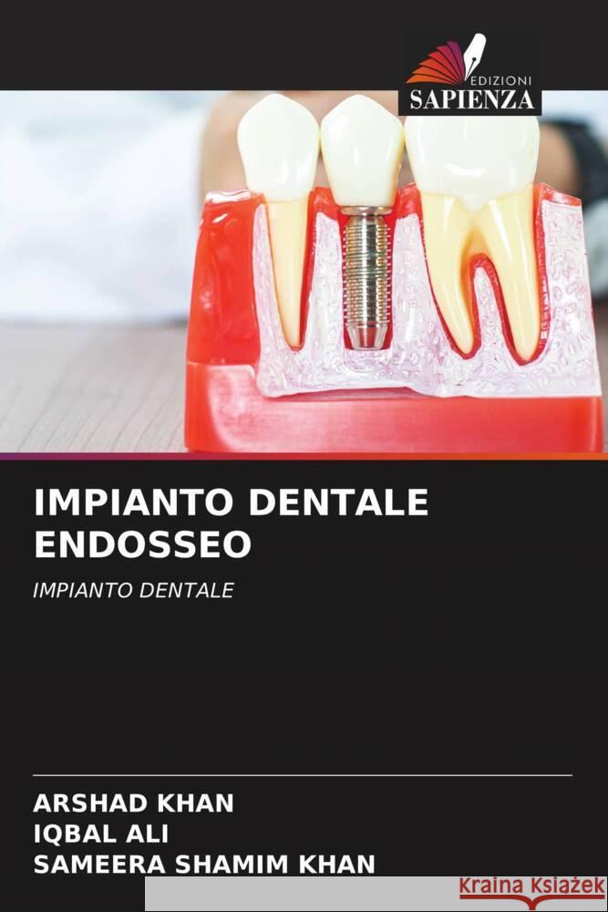 IMPIANTO DENTALE ENDOSSEO Khan, Arshad, Ali, Iqbal, Khan, Sameera Shamim 9786205435519