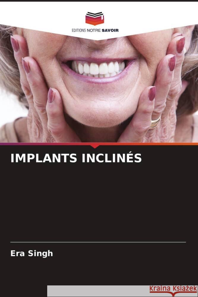 IMPLANTS INCLINÉS Singh, Era 9786205438619 Editions Notre Savoir