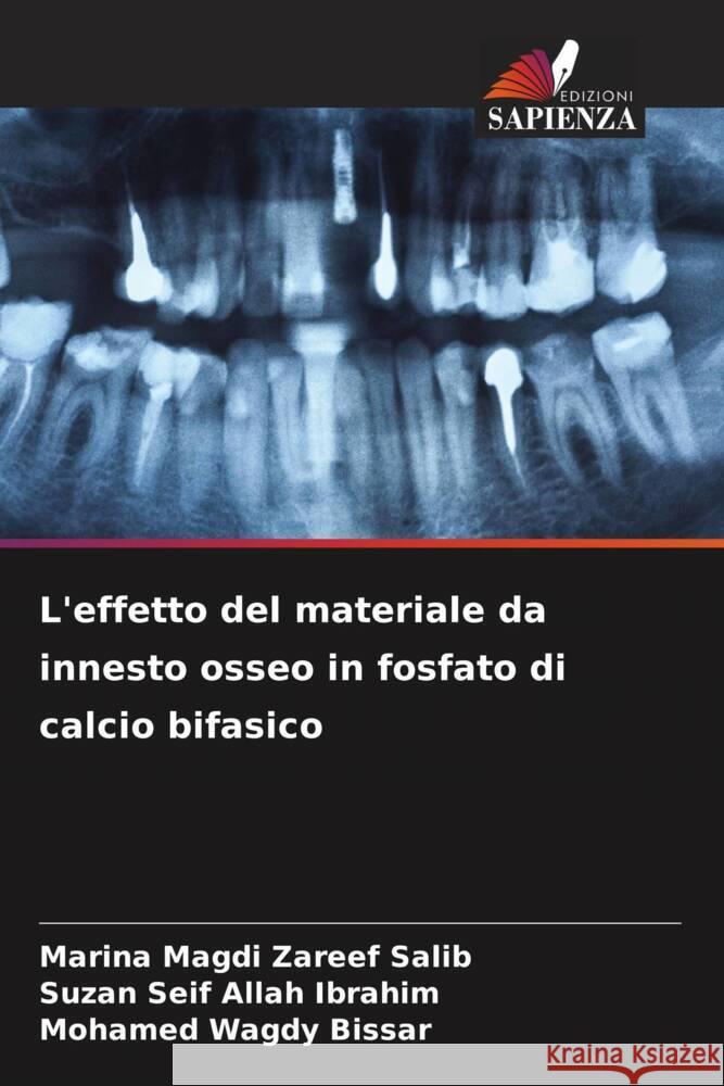 L'effetto del materiale da innesto osseo in fosfato di calcio bifasico Magdi Zareef Salib, Marina, Seif Allah Ibrahim, Suzan, Wagdy Bissar, Mohamed 9786205440636