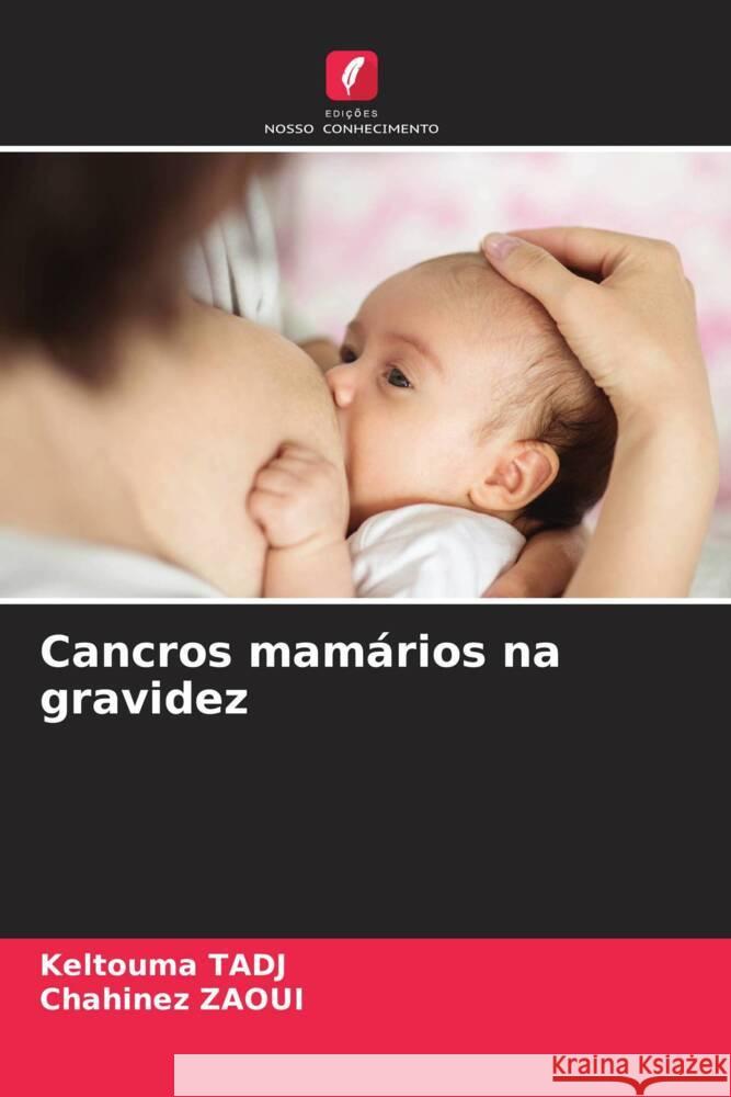 Cancros mamários na gravidez TADJ, Keltouma, ZAOUI, Chahinez 9786205444191 Edições Nosso Conhecimento