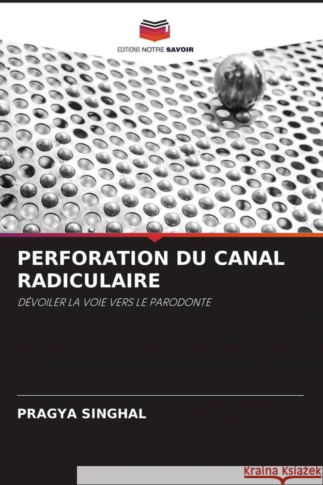 PERFORATION DU CANAL RADICULAIRE SINGHAL, PRAGYA 9786205445686