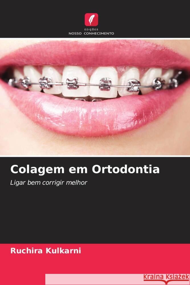 Colagem em Ortodontia Kulkarni, Ruchira 9786205446591