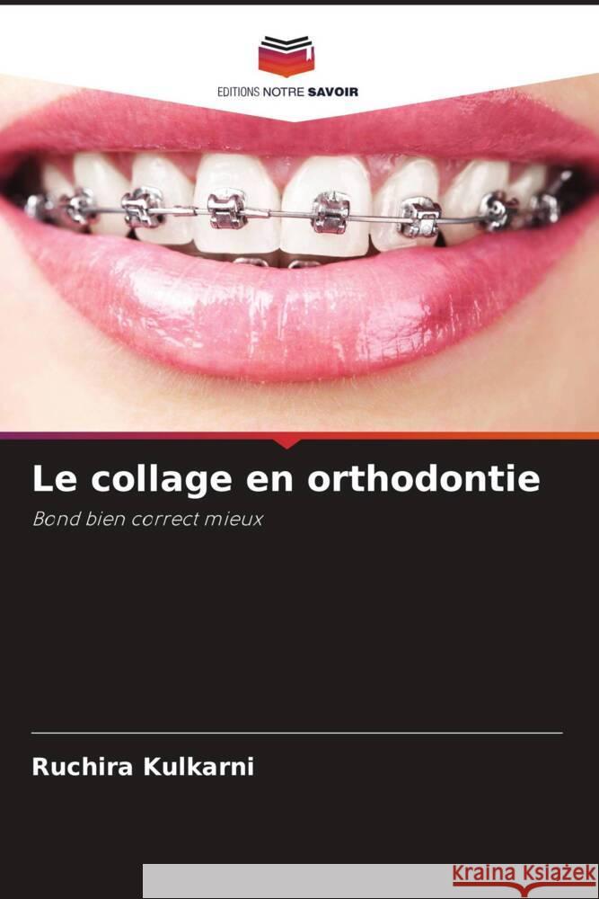 Le collage en orthodontie Kulkarni, Ruchira 9786205446614