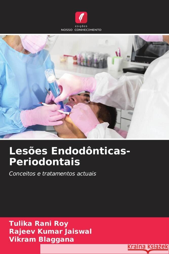 Lesões Endodônticas-Periodontais Roy, Tulika Rani, Jaiswal, Rajeev Kumar, Blaggana, Vikram 9786205447406